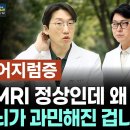 MRI 찍어도 정상인데 3개월째 어지럽다면 이 병 의심하세요 이미지