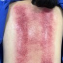 이마트24 청주봉명이글점 | 청주 체형교정 관리 솔직 후기 <기능교정운동연구소> 재활 운동 추천