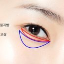 비해피이상양의원