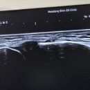 목동신정형외과의원 네이버블로그