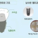 ONE치과기공소 이미지