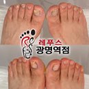 서*균 - 미추홀구 주안서로53번길 26-1 | [광명역 문제성발톱] 레푸스 광명역점, 남편 무좀발톱 관리 솔직후기! (방치하면 안 돼요ㅠㅠ)