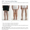 무브먼트짐 | 무릎통증이 생기는 X다리, O다리 교정을 하고 싶다면?