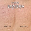 가까운 중앙 약국 | 모공축소 앰플, 피지 조절, 약국 대란템 : 스킨로직랩...컨트랙터 모공 세럼 [내돈내산] 일주일 사용 후기