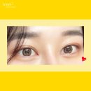 아이콘성형외과의원 이미지