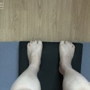 망원동 상실이네+1381 발목골절수술 651일, 핀제거수술 124일 코로나블루? 골절러에겐 골절블루! 골절...