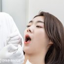 여수즐거운치과의원 | 여수치과 임플란트 받기 전, 이 글 안 보면 손해