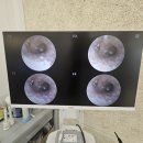 조은소리보청기 포항지사 | 광주보청기 &#39;조은소리보청기 광주전남지사&#39; 방문 후기