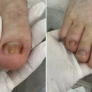 레푸스대전둔산점&더예쁜손발톱
