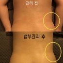 서윤피부맑음 강남구청역점