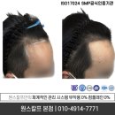 원스칼프 이미지