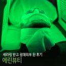 상남동216 | 창원 피부관리 상남동 에린뷰티 광채세라링 효과