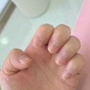 클라씨네일