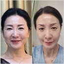 인셀덤탑 | 인셀덤 화장품의 진실, 과연 좋은 화장품일까?