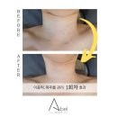 힐테라피 이미지