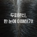 나는 소년이었다 SMP 이미지