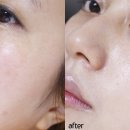 하이얀스킨케어