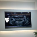 으뜸치과의원 | 내돈내산 계산으뜸치과 스케일링 후기 계양구 경인교대역치과추천