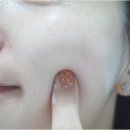 준스킨케어 - 부평구 일신로14번길 16 | 준스킨케어