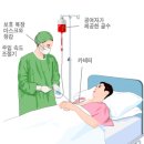 최강희 골수기증과 나 이미지