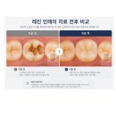 페리오치과기공소 네이버블로그
