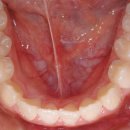 미소가 아름다운 치과교정과치과의원 이미지