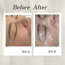 밝음메디 이미지