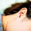 현대침구사 | 침술(Acupuncture), 정말 효과 있을까? 원리부터 배우기·가격·책 추천까지 한눈에!
