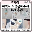 바디모어핏 | 쉽게 빠지지 않는 허벅지살 빼기 | 의정부피부과 지방분해주사 모어컷 효과 부작용 주의사항 후기