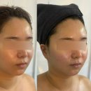 멍투유 | 천안 피부관리 불당동 뷰티투유 에스테틱 윤곽관리
