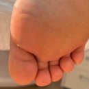 레푸스 화정점 이미지