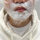 예비부부 청주젠틀맥스프로플러스 제모 후기