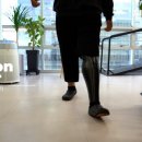 경기 의수족 보조기 이미지