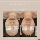 상남동187 | 통증없이 자연스럽게 예뻐지는 얼굴 관리 김해피부관리 블랑뷰티