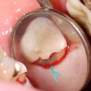 정석치과기공소 이미지