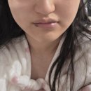 마리앤라인의원 | 제이앤성형외과 포웨이실리프팅 12줄 이중턱 턱라인 내돈내산 솔직후기 일주일차