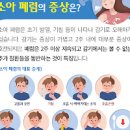 폐렴 (초기) 소아폐렴,노인성폐렴 이미지