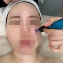 강동-천호-1211 | 천호 피부관리 천호동 / 암사역 [러블랑] mts 관리 받은 후기:)