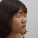 BF라인한의원 네이버블로그