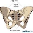 [고관절] 고관절 인공관절수술 잘하는곳 이미지
