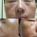 포도힐스3차 | [퓨어힐스/퓨어스4기] 퓨어힐스화산송이포어타이트닝마스크,퓨어힐스모공라인, 모공청소제품추천,클레이...