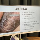 젠디 | 천호 탈모커버 잘하는 곳 찾는다면? 젠디스튜디오 탈모커버 전문샵 리얼 후기_시술과정까지!