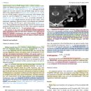 idiopathic vestibular syndrome 환자의 내이에서 FLAIR 상 suppression 정도의 감소 이미지