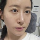 트러블 올라온 날 찾게 되는 저스트비미하이드로겔마스크팩 사용후기