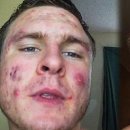 더피트니스케이 이미지