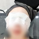 생생의원 | [뷰티 일상] 미국 여행 후 뒤집어진 피부 복구 작전! 인테리어 맛집 '스노우의원'