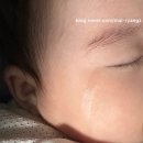 죽봉대로R | 안과 광주정상기안과 올바른 눈물샘마사지 눈물길 노란눈꼽 탐침술 실리콘삽입술 아기비루관 안과방문 후기