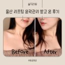 보다나에스테틱 | 울산리프팅 리페어에스테틱에서 윤곽관리 받고 온 후기