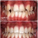 OK치과기공소 이미지