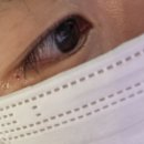 원주김안과의원 이미지